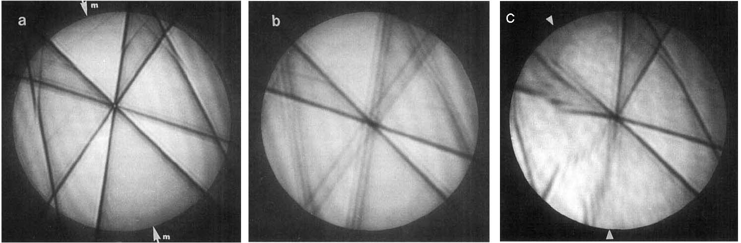 Bright-field discs of convergent electron beam patterns obtained from an Fe-3ONi-19Cr alloy