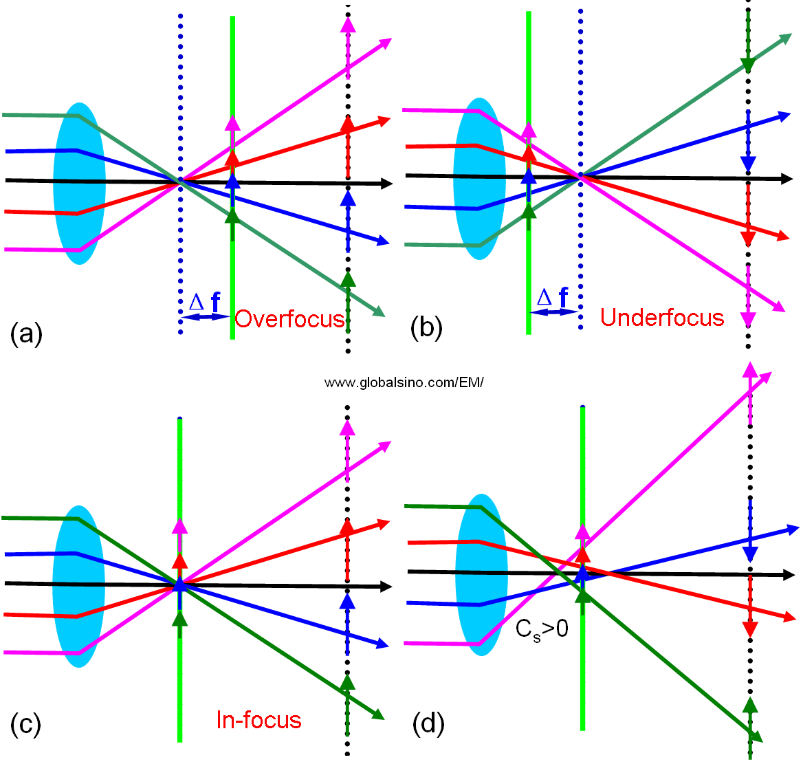 Schematic illustration of the formation of Ronchigram shadow images for different defocus conditions